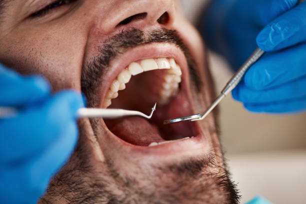 Best Emergency Denture Repair in Burnham, IL