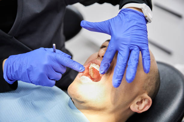 Best Emergency Root Canal Treatment in Burnham, IL
